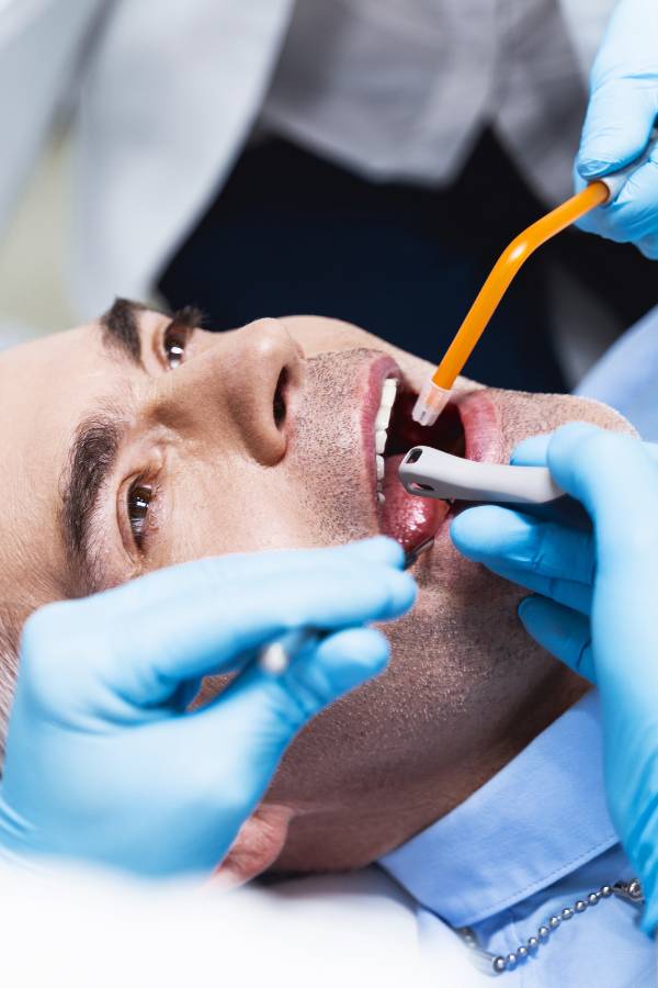 General Dentistry Service - Dental Crowns