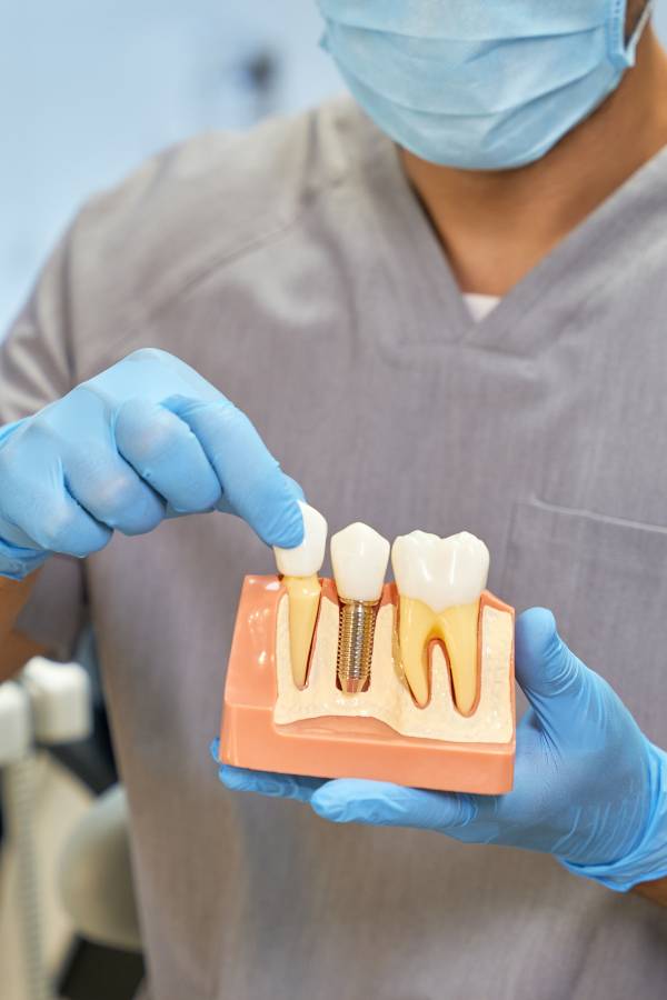 drdalmao-Dental Implants