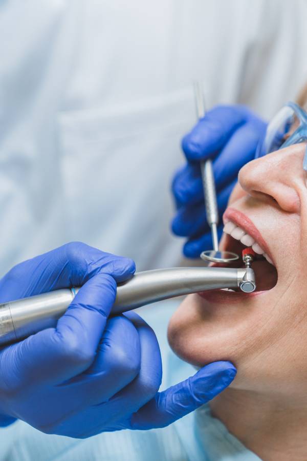 General Dentistry Service - Teeth Whitening