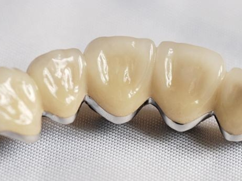 drdalmao-Dental Implants