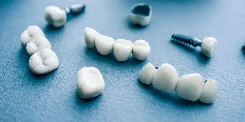 Dental restoration appliances