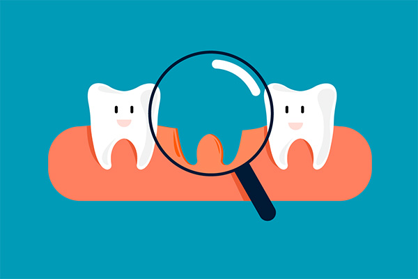 Should you replace missing teeth