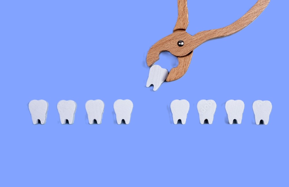 7 Things to Avoid After Tooth Extraction