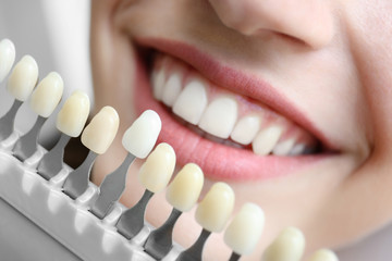 woman choosing the right colour for her teeth