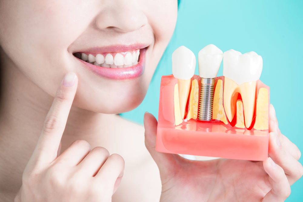 Dental-Implants-Restore-Your-Smile